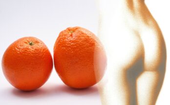 Was hilft gegen Cellulite