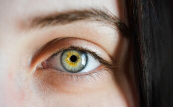Was hilft bei trockenen Augen?