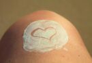 Ein menschliches Knie mit weißer Creme darauf, in die ein Herz gemalt ist.